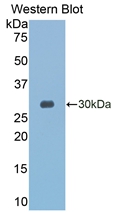 Polyclonal Antibody to Granzyme K (GZMK)