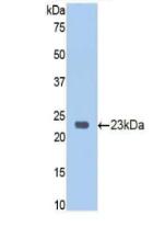 Polyclonal Antibody to Retinoblastoma Protein 1 (RB1)