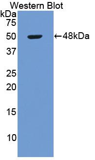 Polyclonal Antibody to Aspartate Aminotransferase (AST)