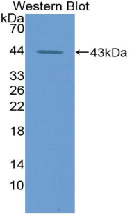 Polyclonal Antibody to Aspartate Aminotransferase (AST)