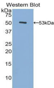 Polyclonal Antibody to Fibrinogen Beta Chain (FGB)