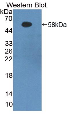 Polyclonal Antibody to Fibrinogen Beta Chain (FGB)