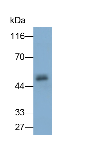 Polyclonal Antibody to Fibrinogen Beta Chain (FGB)