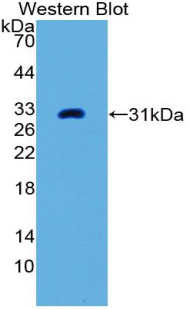 Polyclonal Antibody to Alkaline Phosphatase, Placental (ALPP)