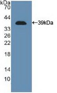 Polyclonal Antibody to Cluster Of Differentiation 56 (CD56)