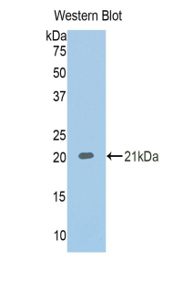 Polyclonal Antibody to Corticosteroid Binding Globulin (CBG)