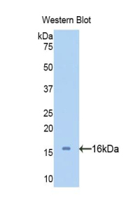 Polyclonal Antibody to Corticosteroid Binding Globulin (CBG)