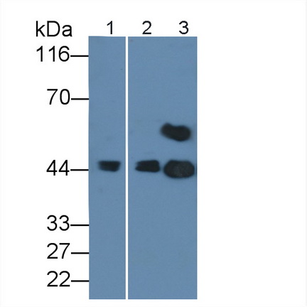 Polyclonal Antibody to Corticosteroid Binding Globulin (CBG)