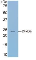 Polyclonal Antibody to Corticosteroid Binding Globulin (CBG)