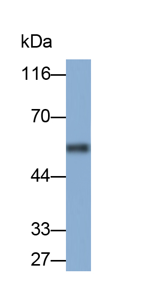 Polyclonal Antibody to Corticosteroid Binding Globulin (CBG)