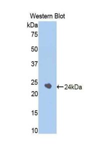 Polyclonal Antibody to Corticosteroid Binding Globulin (CBG)