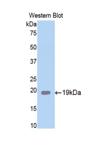 Polyclonal Antibody to Corticosteroid Binding Globulin (CBG)