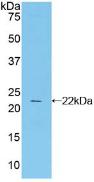 Polyclonal Antibody to Cytotoxic T-Lymphocyte Associated Antigen 4 (CTLA4)