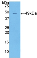 Polyclonal Antibody to Cytokeratin 18 (CK18)