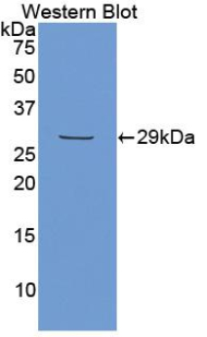 Polyclonal Antibody to Matrix Extracellular Phosphoglycoprotein (MEPE)