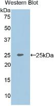 Polyclonal Antibody to Matrix Extracellular Phosphoglycoprotein (MEPE)