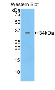 Polyclonal Antibody to Cyclin Dependent Kinase 4 (CDK4)