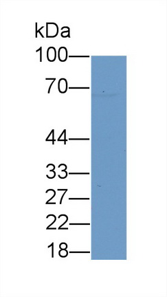 Polyclonal Antibody to Cholinergic Receptor, Muscarinic 5 (CHRM5)