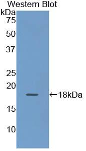 Polyclonal Antibody to Cytokeratin 19 (CK19)