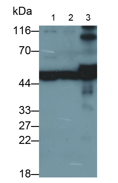 Polyclonal Antibody to Cytokeratin 19 (CK19)