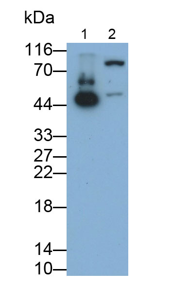 Polyclonal Antibody to Cytokeratin 19 (CK19)