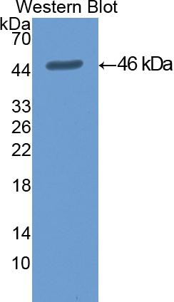 Polyclonal Antibody to Cytokeratin 19 (CK19)