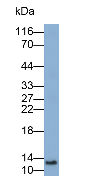 Polyclonal Antibody to Heart-type Fatty Acid Binding Protein (H-FABP)