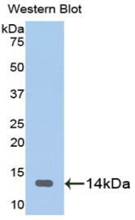 Polyclonal Antibody to Heart-type Fatty Acid Binding Protein (H-FABP)