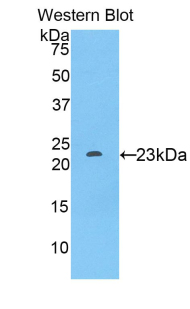 Polyclonal Antibody to Sialic Acid Binding Ig Like Lectin 12 (SIGLEC12)