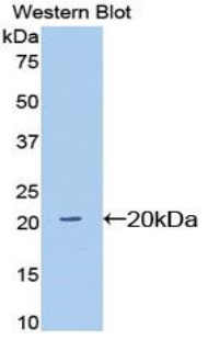 Polyclonal Antibody to Sialic Acid Binding Ig Like Lectin 12 (SIGLEC12)