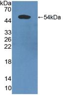 Polyclonal Antibody to Programmed Cell Death Protein 6 Interacting Protein (PDCD6IP)
