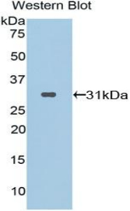 Polyclonal Antibody to Prolylcarboxypeptidase (PRCP)