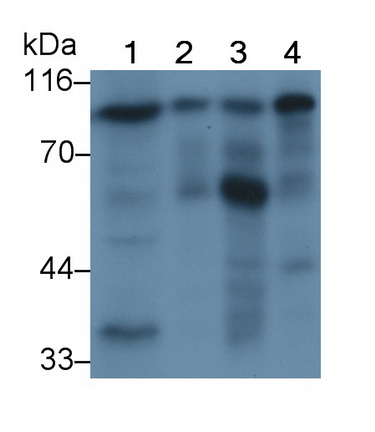 Polyclonal Antibody to Angiostatin (ANG)