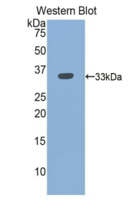 FITC-Linked Polyclonal Antibody to Integrin Beta 3 (ITGb3)