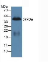 Polyclonal Antibody to Pancreatic Polypeptide (PP)