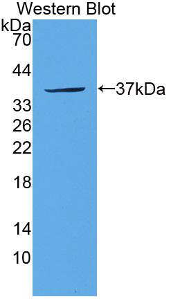 Polyclonal Antibody to Sulfotransferase 1A1 (SULT1A1)