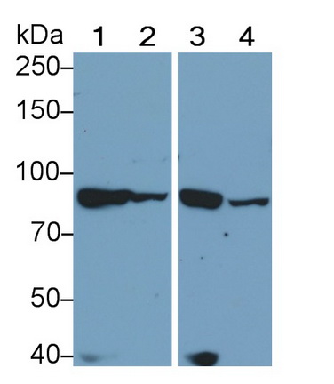 Polyclonal Antibody to Lipase, Hormone Sensitive (LIPE)