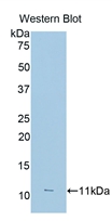 Polyclonal Antibody to Fc Fragment Of IgG Low Affinity IIIa Receptor (FcgR3A)