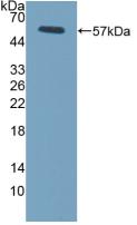 Polyclonal Antibody to Fc Fragment Of IgG Low Affinity IIIa Receptor (FcgR3A)
