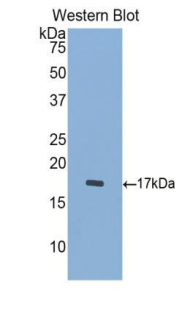 Polyclonal Antibody to Cathepsin D (CTSD)