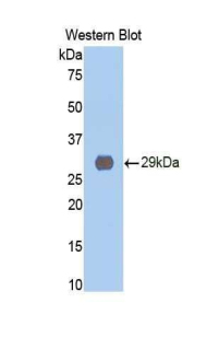 Polyclonal Antibody to Cathepsin D (CTSD)