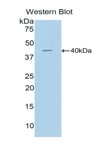 Polyclonal Antibody to Cathepsin D (CTSD)