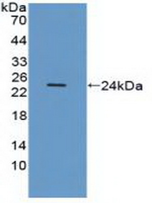 Polyclonal Antibody to Integrin Alpha V (ITGaV)