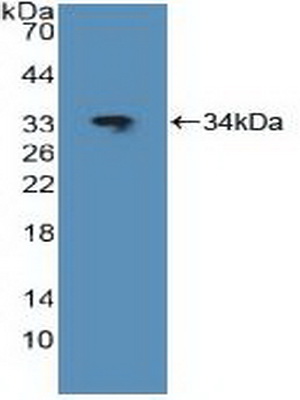 Polyclonal Antibody to V-Jun Sarcoma Virus 17 Oncogene Homolog (JUN)