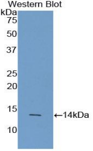 Polyclonal Antibody to Agouti Related Protein (AGRP)