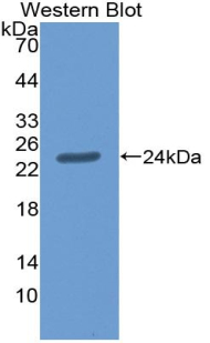 Polyclonal Antibody to Agrin (AGRN)