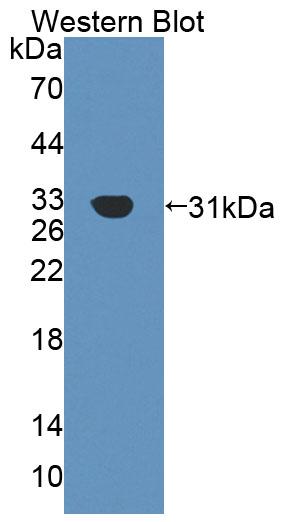 Polyclonal Antibody to Agrin (AGRN)