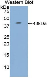 Polyclonal Antibody to Complement Component 8b (C8b)