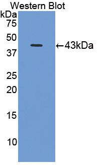 Polyclonal Antibody to Complement Component 8b (C8b)