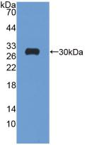 Polyclonal Antibody to Glutathione Reductase (GR)